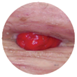 soft or flaccid abdomen